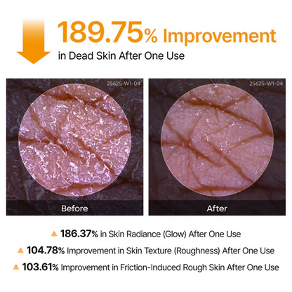Dr.Melaxin Body Keratin Care Kojic Acid Turmeric Spray with AHA & PHA, Gentle Body Brightening & Exfoliating Peeling Solution for Dead Skin Cells & Texture, Korean Skincare, 6.76 fl.o